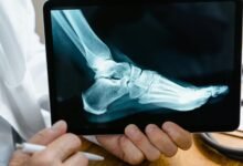 call attempts peak analysis